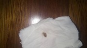 消費(fèi)者稱燕麥片里吃到棗核硌裂牙，廠家：須舉證，否則不會賠